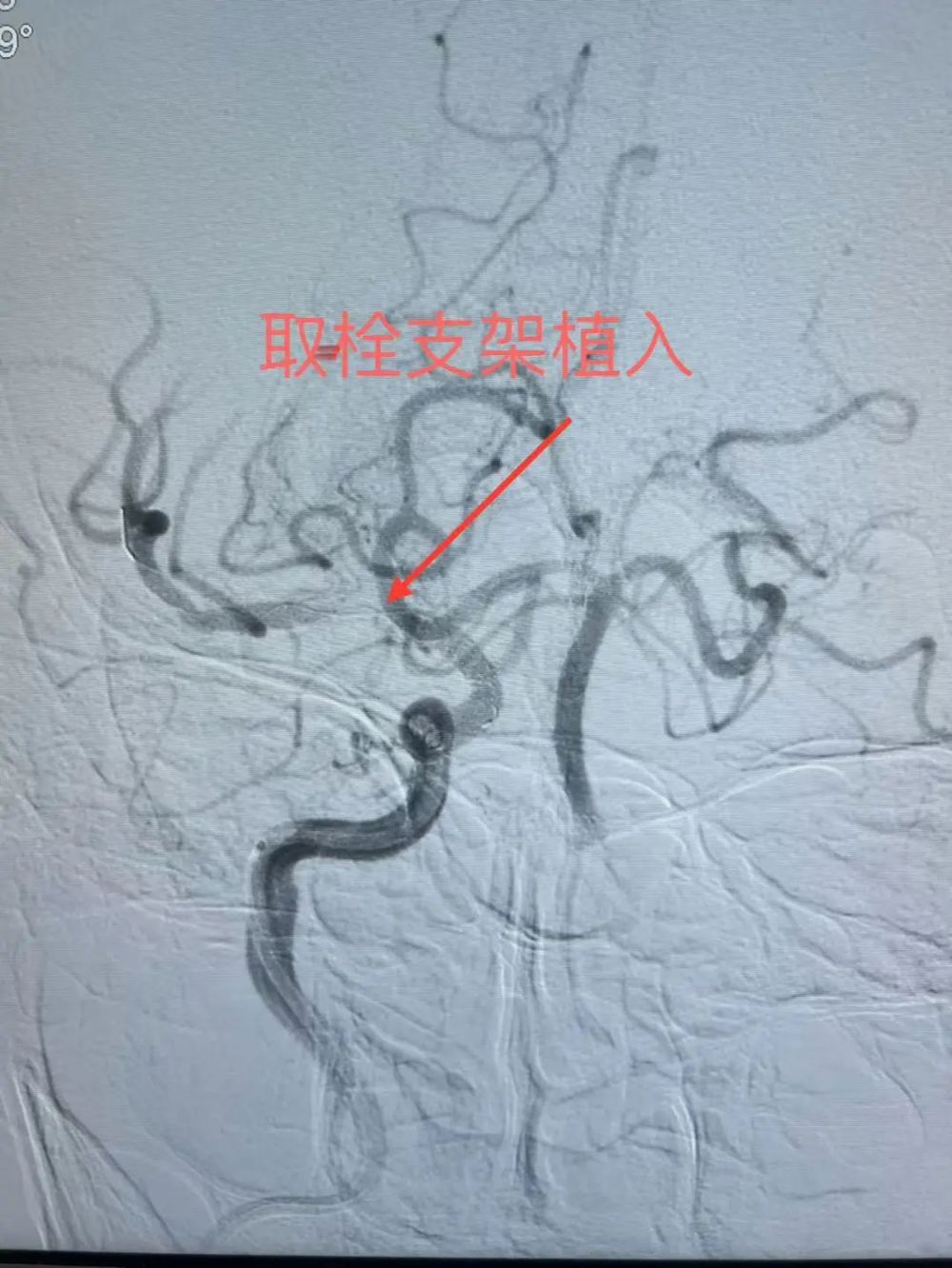 fc6eab545a334a56a201b09387304875.jpg
